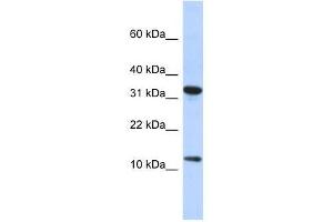 BTF3L1 antibody used at 0. (BTF3P11 Antikörper  (N-Term))