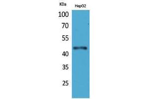 Western Blotting (WB) image for anti-Homeobox D3 (HOXD3) (Internal Region) antibody (ABIN3187731)