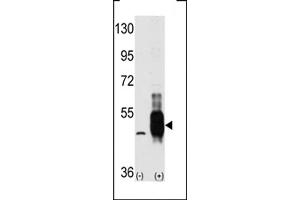 Western blot analysis of MEKK8 using MEKK8 Antibody using 293 cell lysates (2 ug/lane) either nontransfected (Lane 1) or transiently transfected with the MAP3K8 gene (Lane 2). (CROT Antikörper  (C-Term))