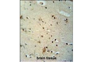 CIC antibody (N-term) (ABIN654662 and ABIN2844358) immunohistochemistry analysis in formalin fixed and paraffin embedded human brain tissue followed by peroxidase conjugation of the secondary antibody and DAB staining. (CIC Antikörper  (N-Term))