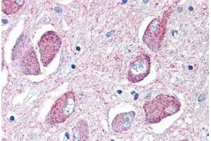 Human Brain, Basal Nucleus of Meynert (formalin-fixed, paraffin-embedded) stained with WNT8B antibody ABIN351424 at 10 ug/ml followed by biotinylated goat anti-rabbit IgG secondary antibody ABIN481713, alkaline phosphatase-streptavidin and chromogen. (WNT8B Antikörper  (Internal Region))