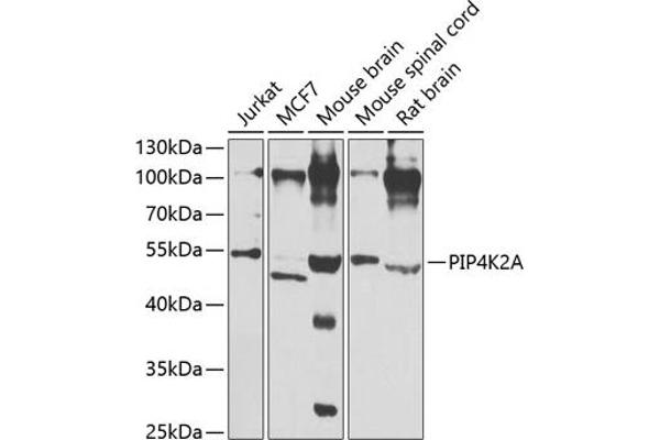 PIP4K2A Antikörper  (AA 120-350)
