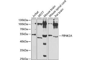 Western blot analysis of extracts of various cell lines, using PIP4K2A antibody (ABIN6130624, ABIN6145673, ABIN6145674 and ABIN6223324) at 1:1000 dilution.