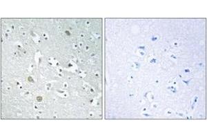 Immunohistochemistry analysis of paraffin-embedded human brain, using PLA1A Antibody. (PLA1A Antikörper  (AA 381-430))