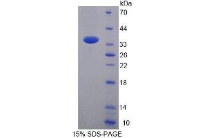 SDS-PAGE (SDS) image for Acetyl-CoA Acyltransferase 2 (ACAA2) (AA 90-397) protein (His tag) (ABIN4989940) (ACAA2 Protein (AA 90-397) (His tag))
