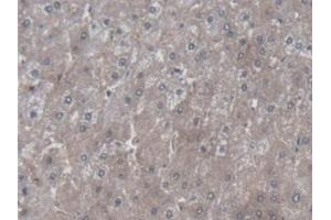 Detection of SYMPK in Human Liver Tissue using Polyclonal Antibody to Symplekin (SYMPK) (Symplekin Antikörper  (AA 1-347))