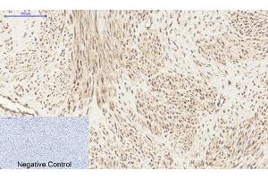 Immunohistochemical analysis of paraffin-embedded human uterus tissue. (PI3K p85 alpha/gamma Antikörper)