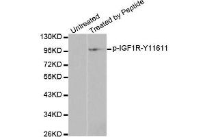 Western blot analysis of extracts from 293 cells, using Phospho-IGF1R-Y1161 antibody (ABIN2988064). (IGF1R Antikörper  (pTyr1161))