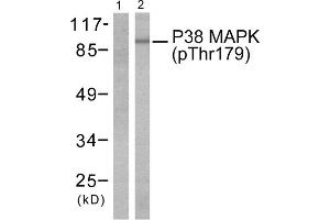 Western blot analysis of extracts from Hela cells treated with TNF- alpha (20ng/ml, 5mins), using P38 MAPK (phospho-Thr180) antibody (Line 1 and 2). (MAPK14 Antikörper  (pThr180))