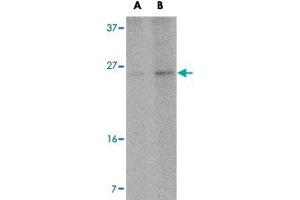 Western blot analysis of RCAN2 in NIH/3T3 cell lysate with RCAN2 polyclonal antibody  at (A) 1 and (B) 2 ug/mL . (RCAN2 Antikörper  (Internal Region))