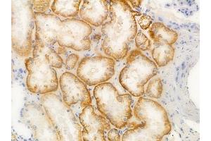 anti-Synaptonemal Complex Protein 1 (SYCP1) (C-Term) antibody