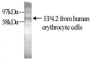 Western Blot (10% gel) with the anti-transglutaminase antibody EP4.