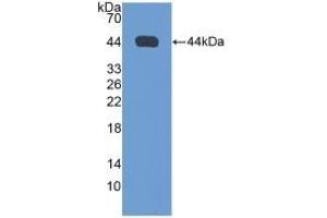 Detection of Recombinant NPPA, Rat using Polyclonal Antibody to Natriuretic Peptide Precursor A (NPPA) (NPPA Antikörper  (AA 25-152))