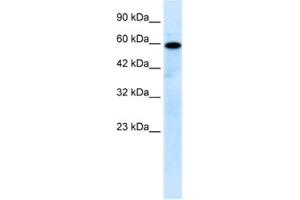 Western Blotting (WB) image for anti-Mucolipin 1 (MCOLN1) antibody (ABIN2461126) (MCOLN1 Antikörper)