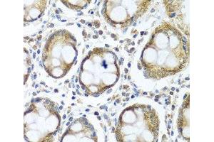 Immunohistochemistry of paraffin-embedded Human colon using IFI44 Polyclonal Antibody at dilution of 1:100 (40x lens). (IFI44 Antikörper)