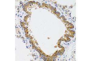 Immunohistochemistry of paraffin-embedded rat lung using CHMP4B antibody. (CHMP4B Antikörper  (AA 1-224))