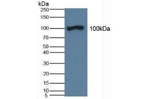 Detection of ABP1 in Porcine Kidney Tissue using Polyclonal Antibody to Amiloride Binding Protein 1 (ABP1) (DAO Antikörper  (AA 347-466))