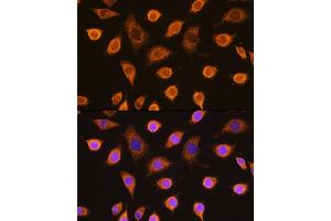 Immunofluorescence analysis of L929 cells using SDHB Rabbit pAb (ABIN6131588, ABIN6147472, ABIN6147474 and ABIN6215002) at dilution of 1:100. (SDHB Antikörper  (AA 29-280))