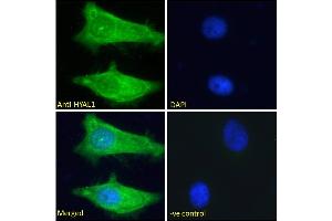 ABIN334421 Immunofluorescence analysis of paraformaldehyde fixed HeLa cells, permeabilized with 0.