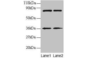 Western blot All lanes: HNRNPH1 antibody at 2 μg/mL Lane 1: EC109 whole cell lysate Lane 2: 293T whole cell lysate Secondary Goat polyclonal to rabbit IgG at 1/15000 dilution Predicted band size: 50 kDa Observed band size: 36 kDa