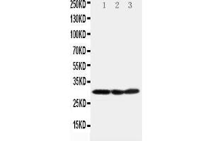 Anti-COMT antibody, Western blotting Lane 1: HELA Cell Lysate Lane 2: A375 Cell Lysate Lane 3: PANC Cell Lysate