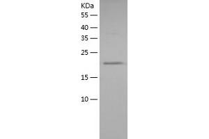 Heat Shock 27kDa Protein 1 (HSPB1) (AA 1-205) protein (His tag)