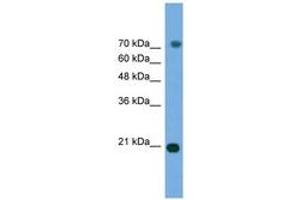 Image no. 1 for anti-Mitogen-Activated Protein Kinase 6 (MAPK6) (AA 395-444) antibody (ABIN6746449) (MAPK6 Antikörper  (AA 395-444))