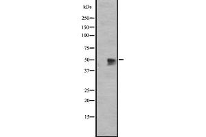 Western blot analysis of GPR12 expression in HEK293 cells ,The lane on the left is treated with the antigen-specific peptide.