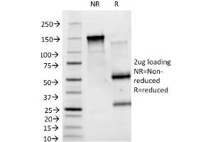 SDS-PAGE Analysis Purified Blood Group B Monoclonal Antibody (HEB-20). (ABO Antikörper)