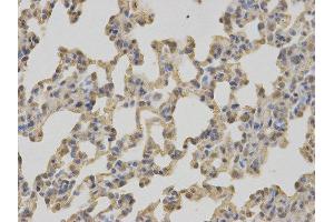 Immunohistochemistry (IHC) image for anti-Complement Component 1, Q Subcomponent Binding Protein (C1QBP) antibody (ABIN1871379) (C1QBP Antikörper)