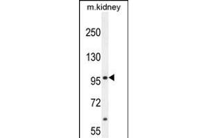 MED25 Antibody (N-term) (ABIN654162 and ABIN2844026) western blot analysis in mouse kidney tissue lysates (35 μg/lane). (MED25 Antikörper  (AA 112-140))