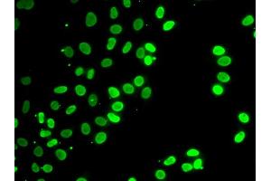 Immunofluorescence analysis of HeLa cells using SEPT7 antibody (ABIN6291642).