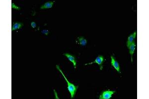 Immunofluorescent analysis of U251 cells using ABIN7171850 at dilution of 1:100 and Alexa Fluor 488-congugated AffiniPure Goat Anti-Rabbit IgG(H+L) (Tetraspanin 14 Antikörper  (AA 114-215))