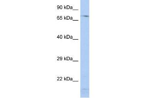 WB Suggested Anti-SRP72 Antibody Titration:  0. (SRP72 Antikörper  (Middle Region))