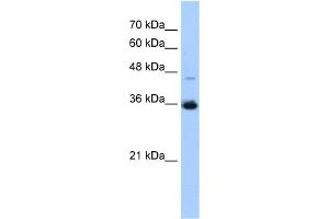 WB Suggested Anti-GGPS1 Antibody Titration:  0.