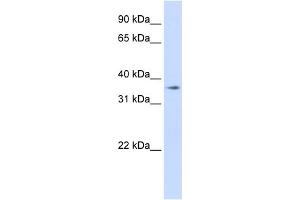 WB Suggested Anti-TMEM30B Antibody Titration:  0. (TMEM30B Antikörper  (Middle Region))