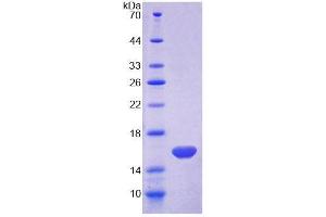 SDS-PAGE analysis of Human MARS Protein. (MARS Protein)