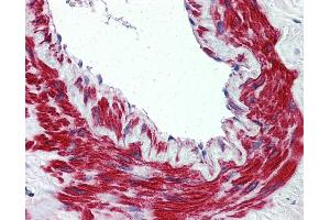 Anti-TRPM8 antibody IHC of human lung, vessel. (TRPM8 Antikörper  (N-Term))
