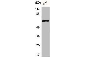 Western Blot analysis of HuvEc cells using ADCK5 Polyclonal Antibody (ADCK5 Antikörper  (Internal Region))
