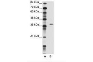 Image no. 1 for anti-Zinc Finger Protein 444 (ZNF444) (AA 251-300) antibody (ABIN202253)