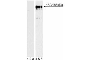 Western blot analysis of IRS-1 (pY896) in transformed human epithelial cells.