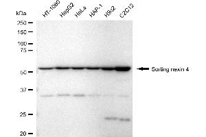 Western blotting analysis using sorting nexin 4 antibody (ABIN7800409). (Rekombinanter Sorting Nexin 4 Antikörper)