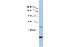 ZZZ3 antibody used at 0. (ZZZ3 Antikörper  (Middle Region))