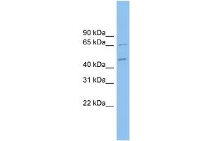 WB Suggested Anti-MDH1B Antibody Titration: 0. (MDH1B Antikörper  (Middle Region))