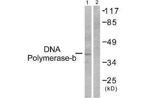 Western blot analysis of extracts from NIH/3T3 cells, using DNA Polymerase beta antibody (ABIN5976381). (POLB Antikörper  (C-Term))