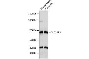 Western blot analysis of extracts of various cell lines, using SLC18 Polyclonal Antibody (ABIN7270410) at 1:1000 dilution. (SLC18A3 Antikörper  (AA 1-150))