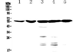 Western blot analysis of NR1H4 using anti-NR1H4 antibody .