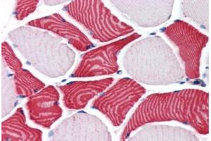 Human Skeletal Muscle (formalin-fixed, paraffin-embedded) stained with EBAG9 antibody ABIN351484 at 3. (RCAS1 Antikörper  (AA 240-251))