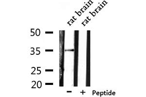 Western blot analysis of extracts from rat brain, using OR6N1 Antibody. (OR6N1 Antikörper)