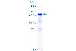 NF-kB p65 Protein (AA 1-220) (GST tag)